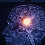 Escaneo cerebral con brillo etéreo mostrando la glándula pineal, representada como un centro bioluminiscente, sobre un fondo de resonancia magnética.